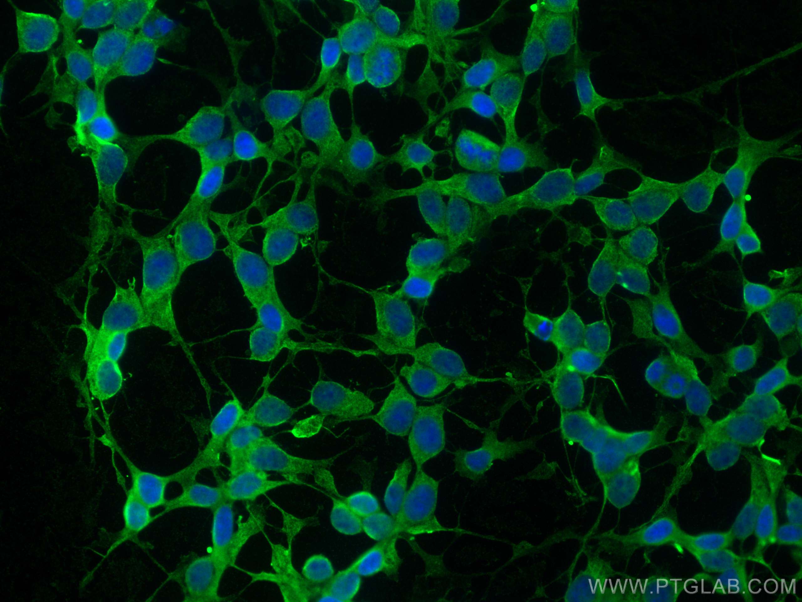 Immunofluorescence (IF) / fluorescent staining of SH-SY5Y cells using FAM131B Polyclonal antibody (26498-1-AP)