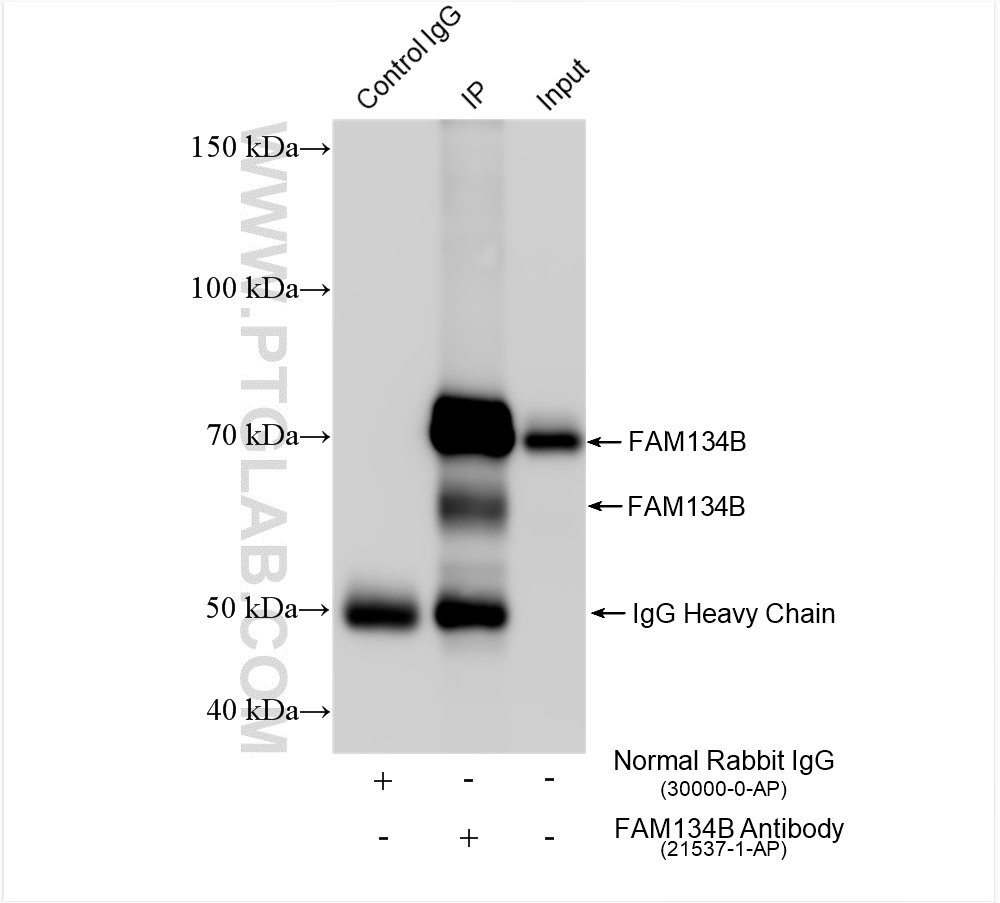 Immunoprecipitation (IP) experiment of Jurkat cells using FAM134B Polyclonal antibody (21537-1-AP)