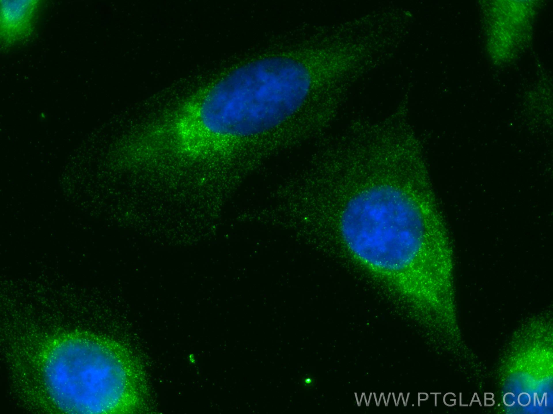 Immunofluorescence (IF) / fluorescent staining of U2OS cells using FAM134C Polyclonal antibody (26330-1-AP)