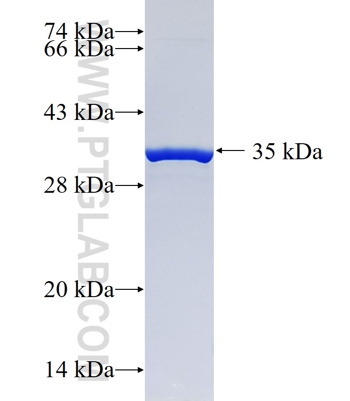 FAM164B fusion protein Ag22953 SDS-PAGE