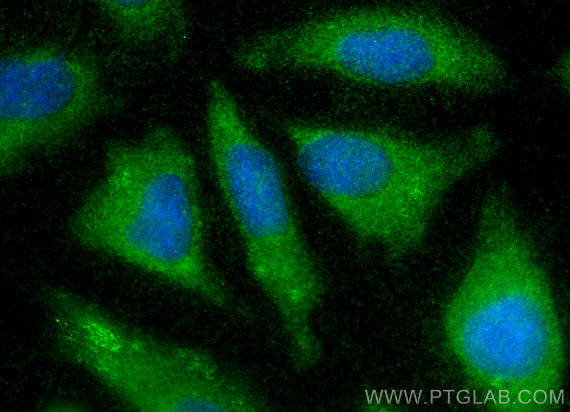 Immunofluorescence (IF) / fluorescent staining of HeLa cells using FAM175A Polyclonal antibody (14366-1-AP)