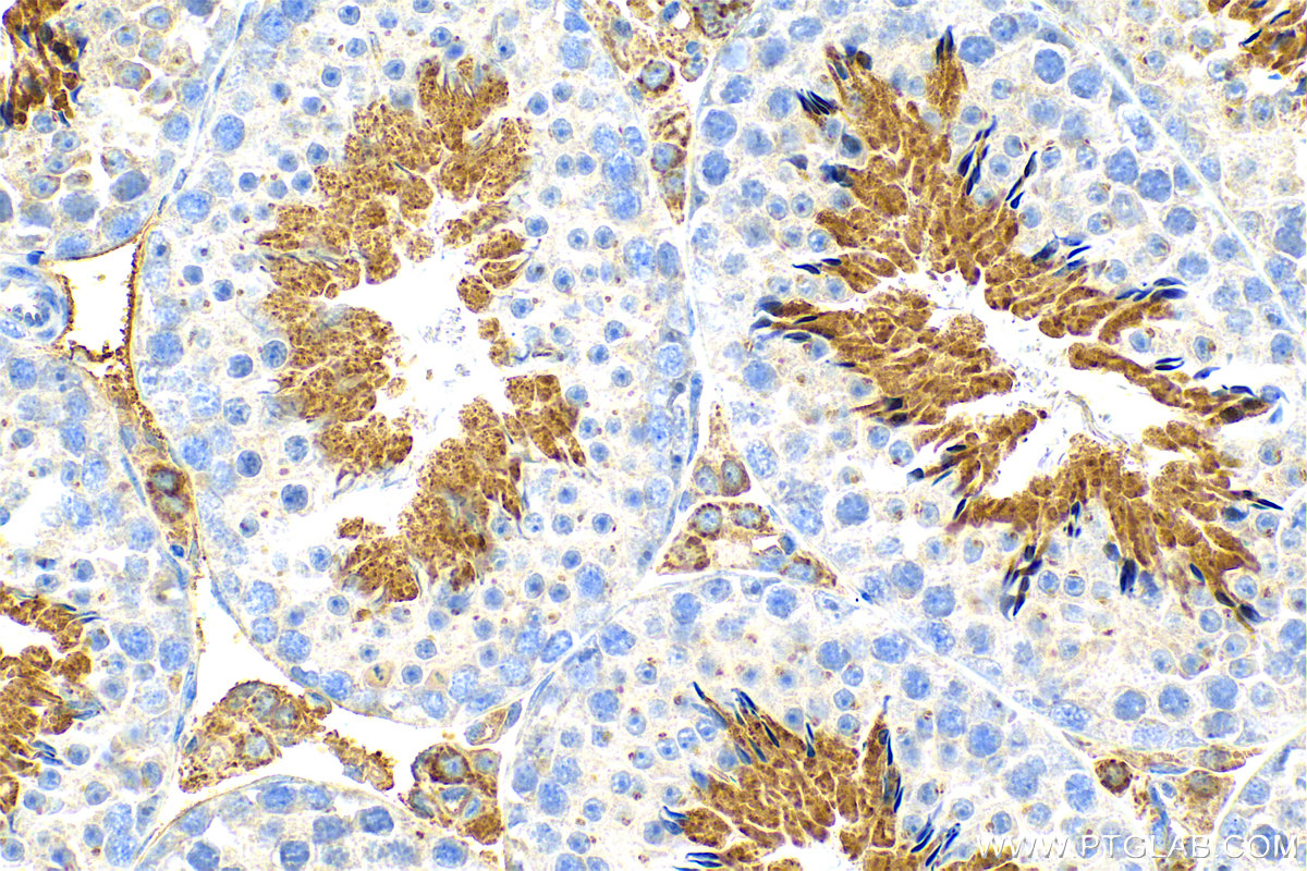 Immunohistochemistry (IHC) staining of mouse testis tissue using FAM181A Polyclonal antibody (26509-1-AP)