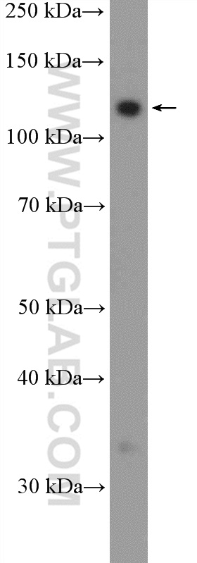 Western Blot (WB) analysis of HeLa cells using FAM186B Polyclonal antibody (21022-1-AP)