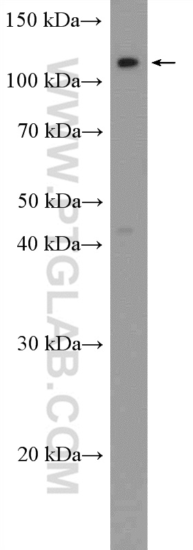 Western Blot (WB) analysis of MCF-7 cells using FAM186B Polyclonal antibody (21022-1-AP)