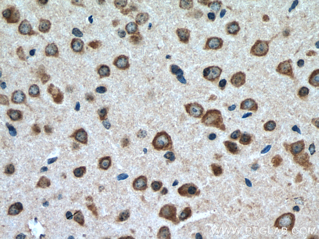 Immunohistochemistry (IHC) staining of mouse brain tissue using FAM19A5 Polyclonal antibody (13948-1-AP)