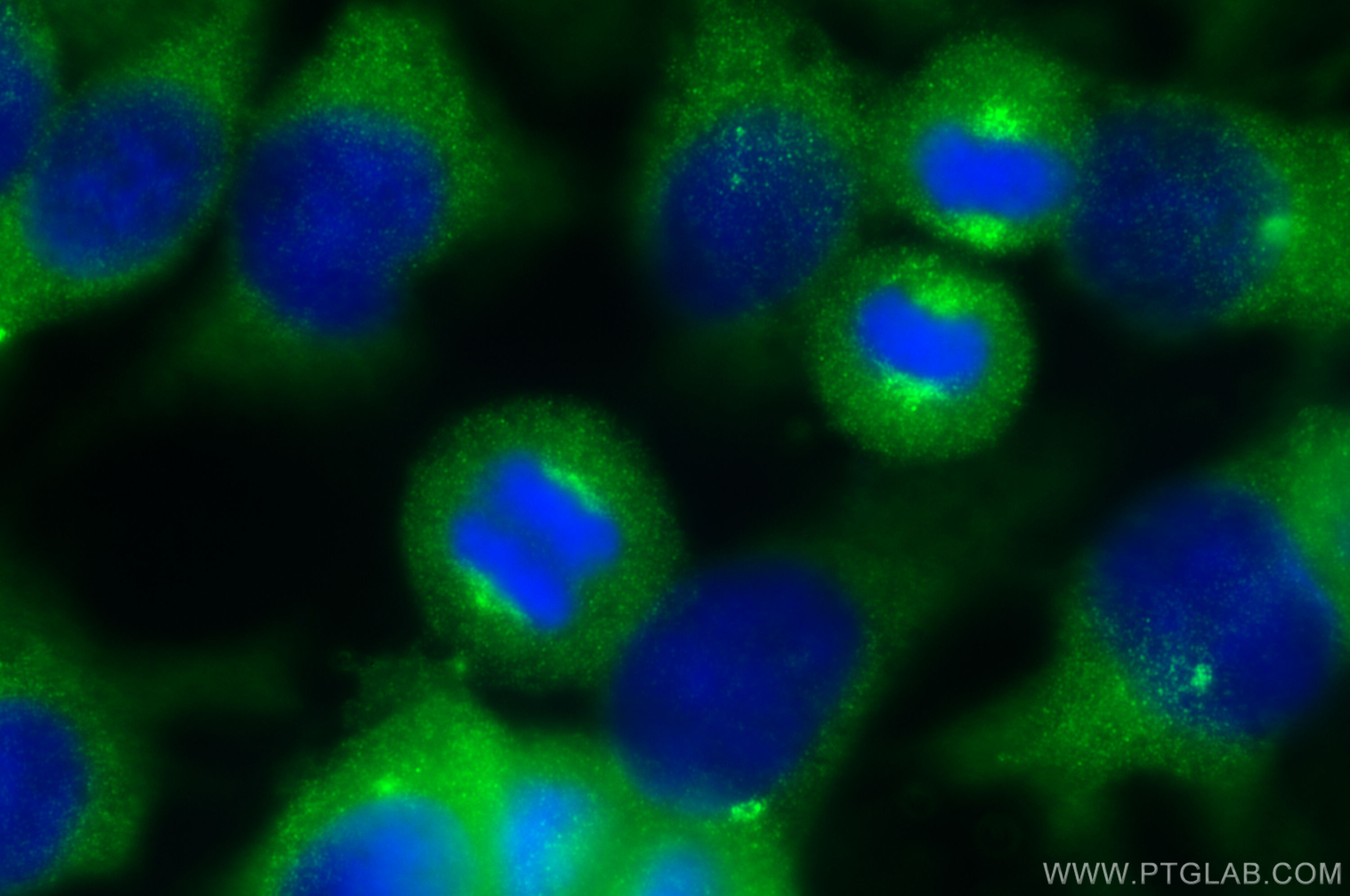 Immunofluorescence (IF) / fluorescent staining of HeLa cells using FAM29A Polyclonal antibody (16933-1-AP)