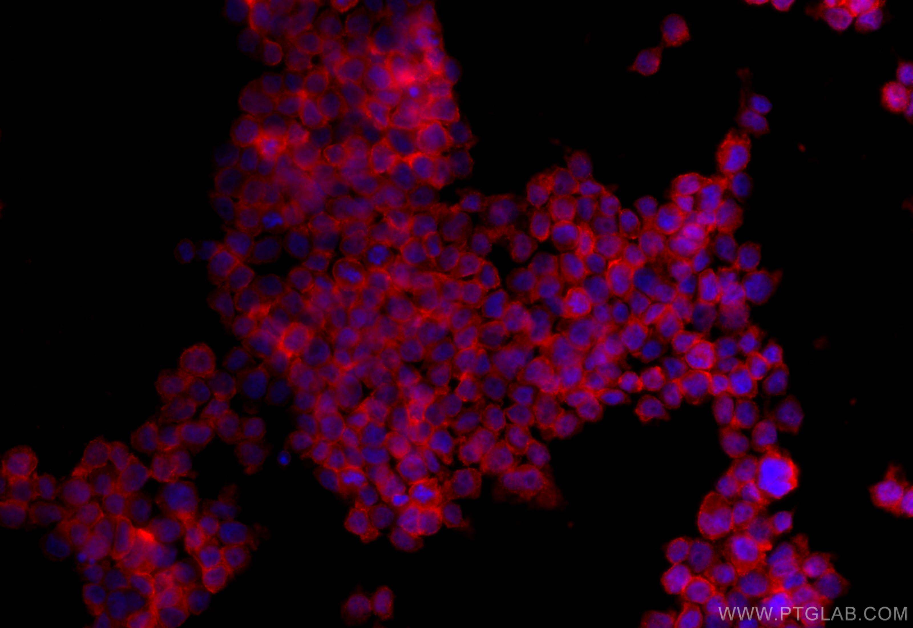 Immunofluorescence (IF) / fluorescent staining of THP-1 cells using Piezo1 (extracellular domain) Polyclonal antibody (15939-1-AP)