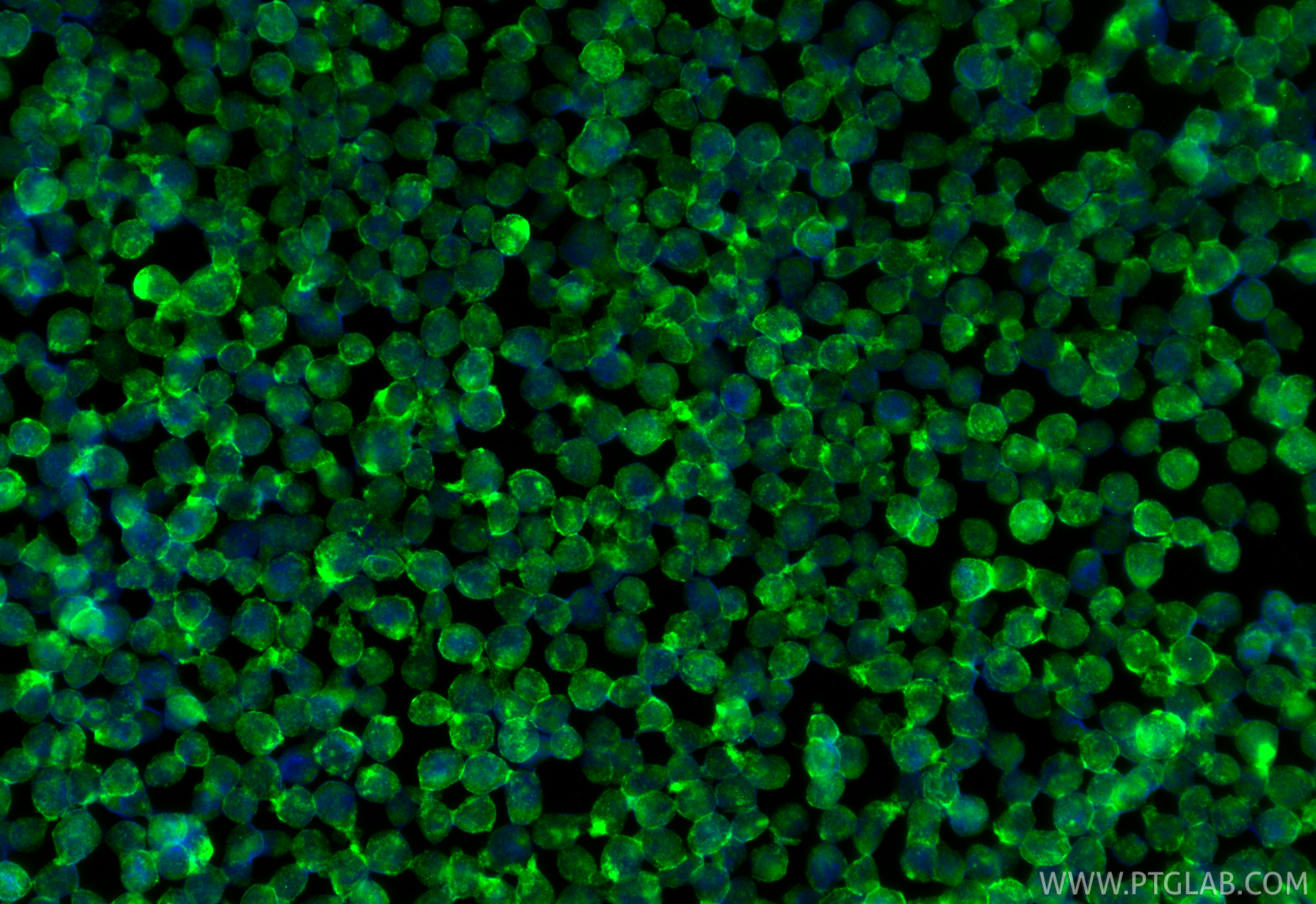 Immunofluorescence (IF) / fluorescent staining of THP-1 cells using Piezo1 (extracellular domain) Polyclonal antibody (15939-1-AP)