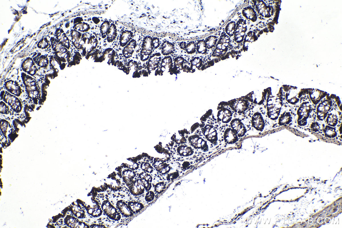 Immunohistochemistry (IHC) staining of rat colon tissue using FAM50A Polyclonal antibody (19849-1-AP)