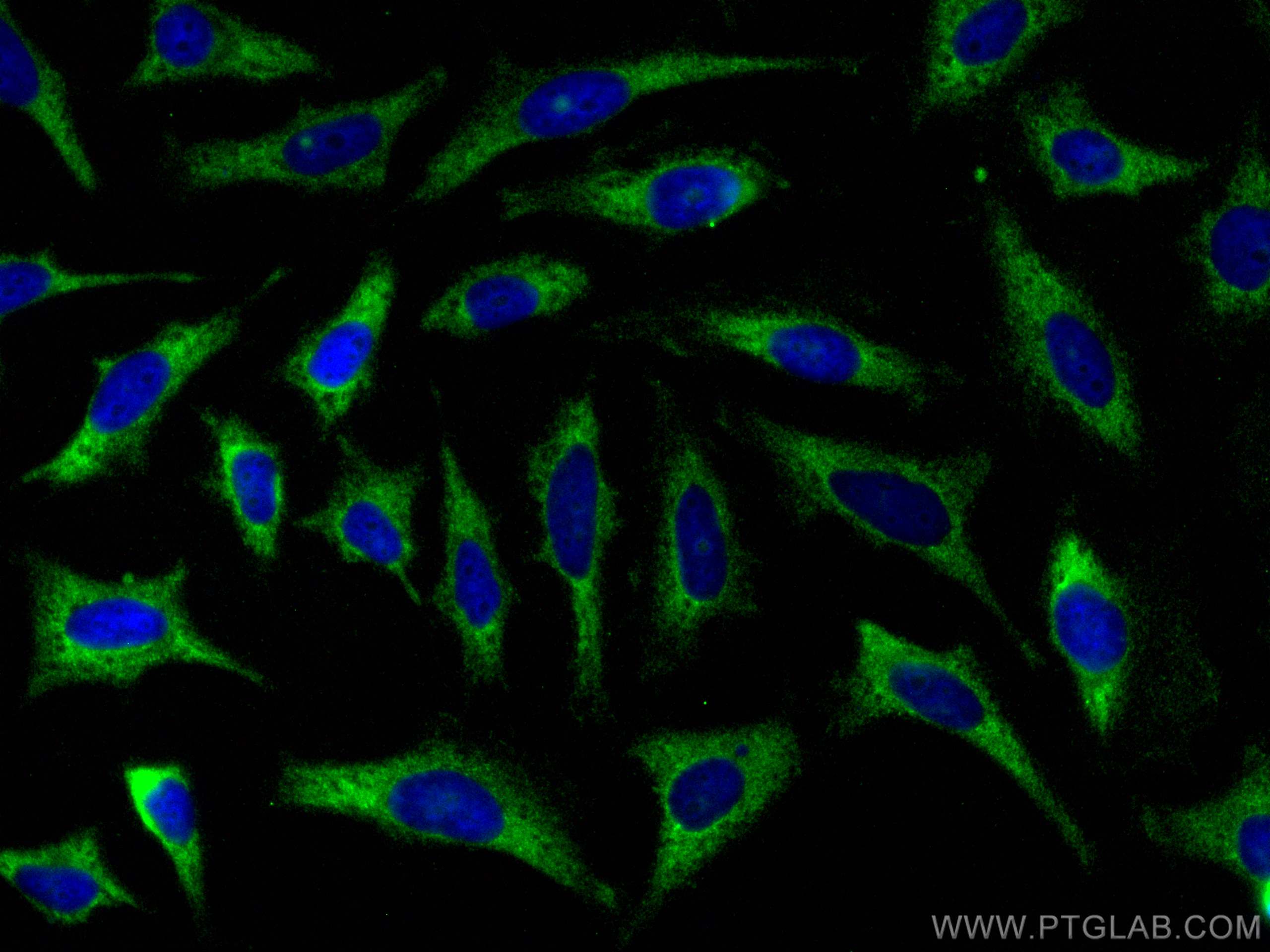 Immunofluorescence (IF) / fluorescent staining of HeLa cells using FAM54A Polyclonal antibody (26569-1-AP)