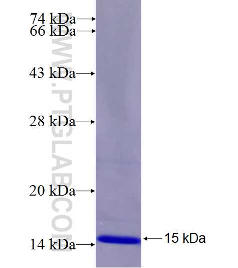 FAM91A1 fusion protein Ag26915 SDS-PAGE