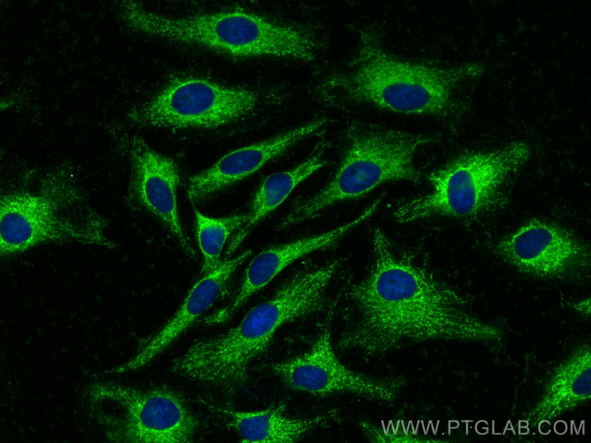 Immunofluorescence (IF) / fluorescent staining of HeLa cells using FAM92A1 Polyclonal antibody (24803-1-AP)