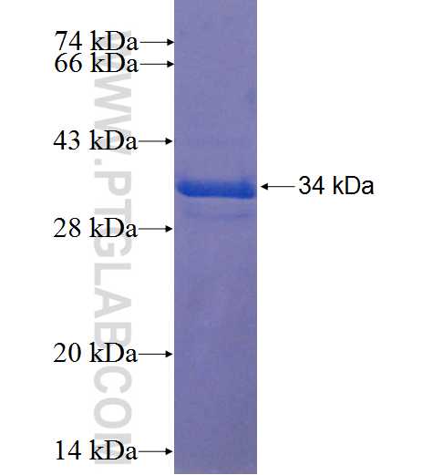 FAM9B fusion protein Ag22560 SDS-PAGE