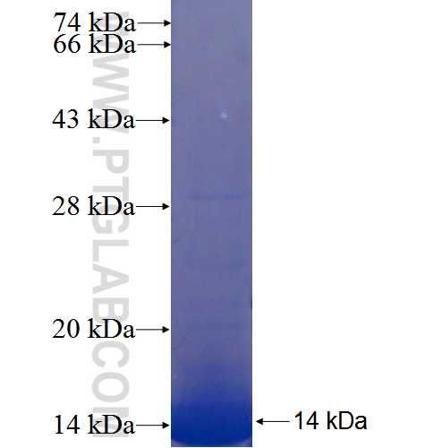 FAM9B fusion protein Ag22746 SDS-PAGE