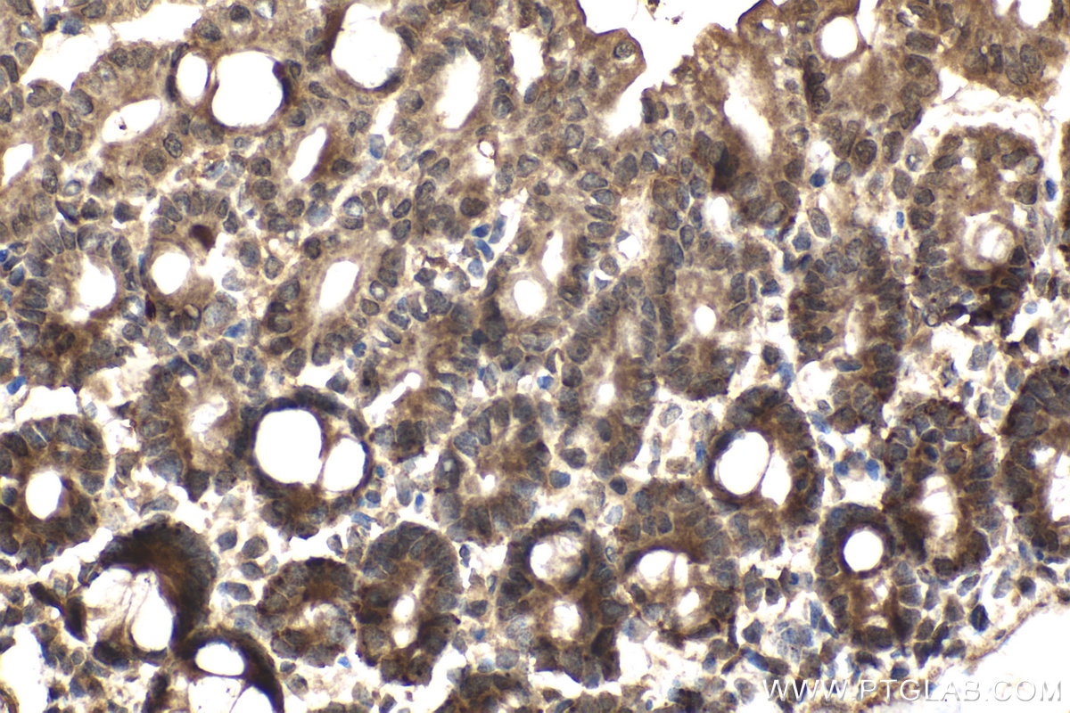 Immunohistochemistry (IHC) staining of mouse intestine using FANCA Polyclonal antibody (11975-1-AP)