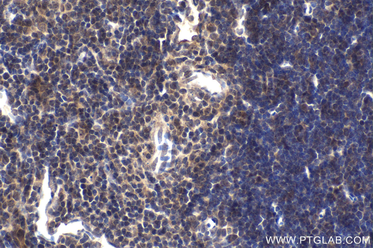 Immunohistochemistry (IHC) staining of mouse thymus tissue using FANCA Polyclonal antibody (11975-1-AP)