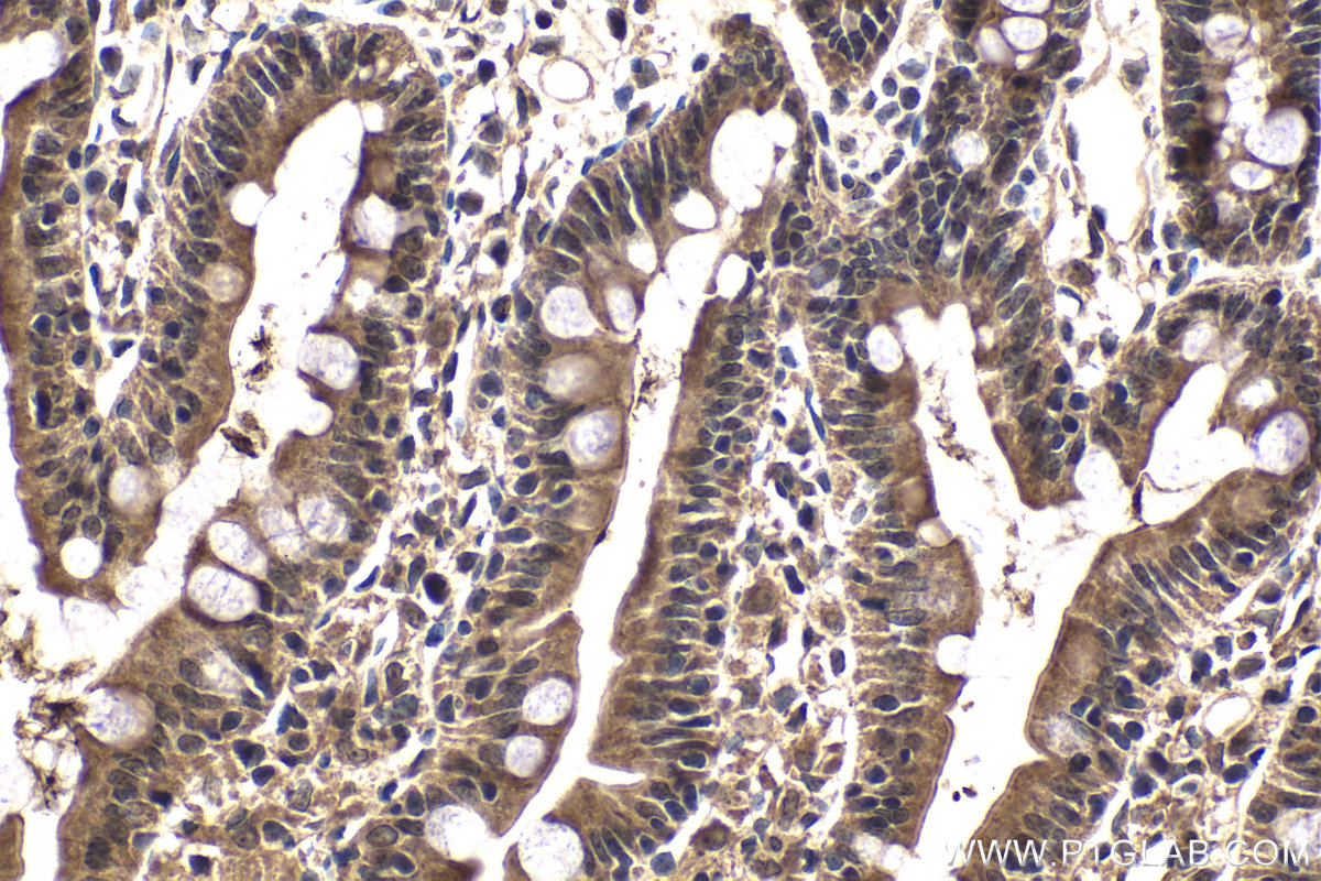 Immunohistochemistry (IHC) staining of rat small intestine tissue using FANCA Polyclonal antibody (11975-1-AP)