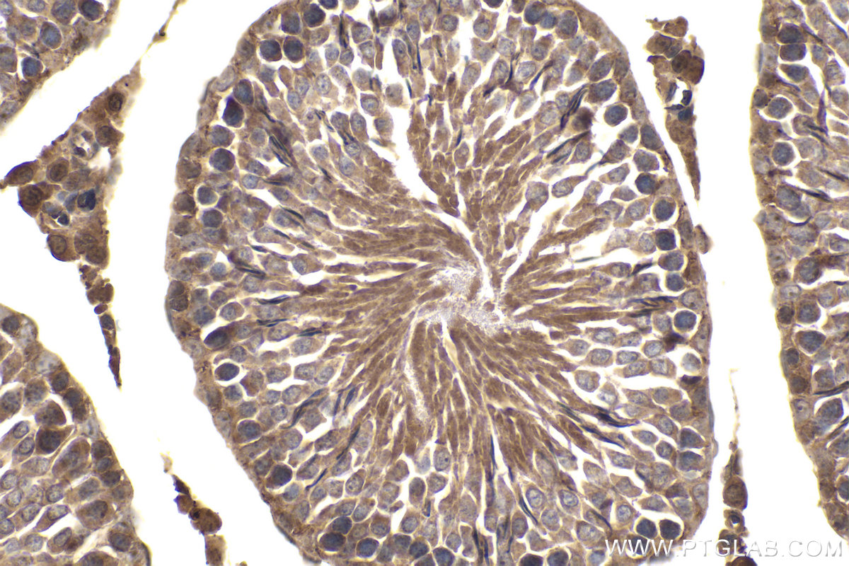 Immunohistochemistry (IHC) staining of rat testis tissue using FANCA Polyclonal antibody (11975-1-AP)