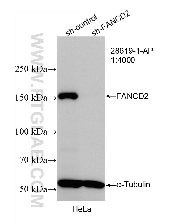 Western Blot (WB) analysis of HeLa cells using FANCD2 Polyclonal antibody (28619-1-AP)