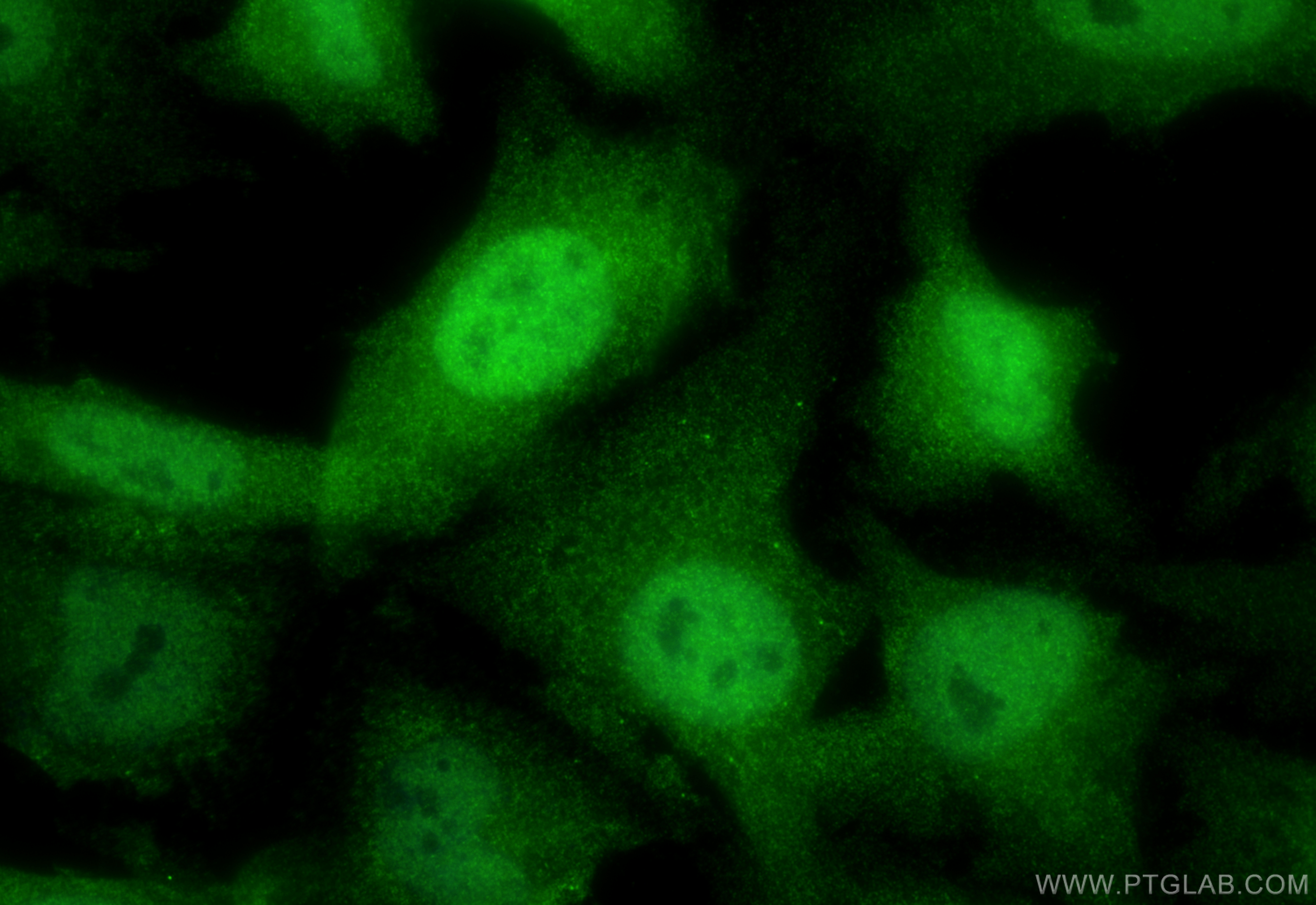 Immunofluorescence (IF) / fluorescent staining of HeLa cells using FANCG Polyclonal antibody (10215-1-AP)