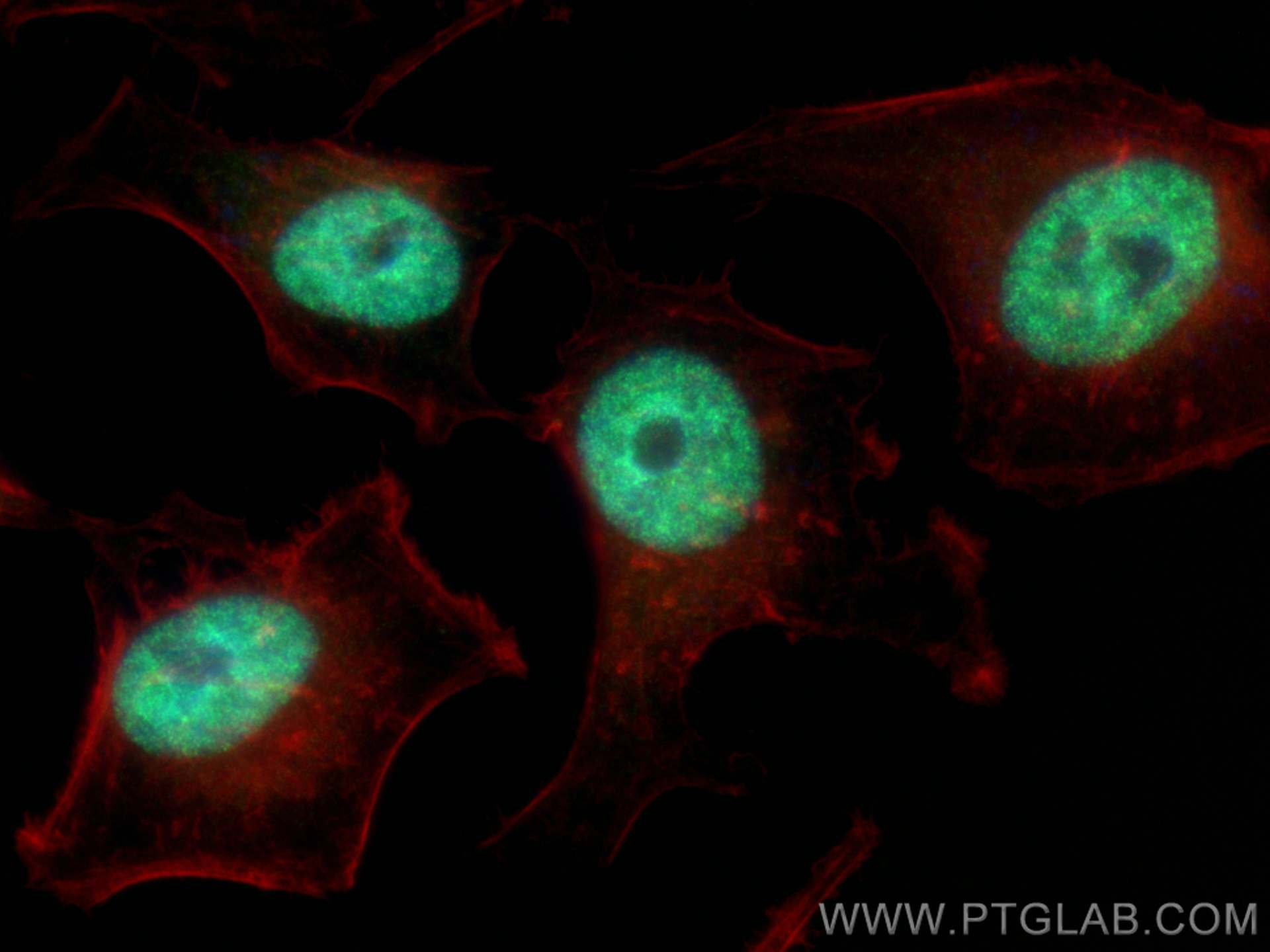 Immunofluorescence (IF) / fluorescent staining of HeLa cells using FANCM Recombinant antibody (82897-2-RR)