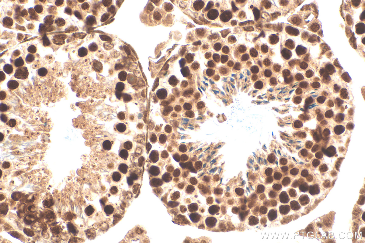 Immunohistochemistry (IHC) staining of mouse testis tissue using FANCM Recombinant antibody (82897-2-RR)