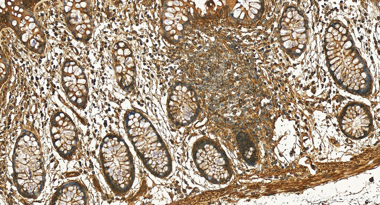 Immunohistochemistry (IHC) staining of human colon tissue using FAR2 Polyclonal antibody (27717-1-AP)