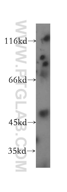 Western Blot (WB) analysis of human cerebellum tissue using FARS2 Polyclonal antibody (16436-1-AP)