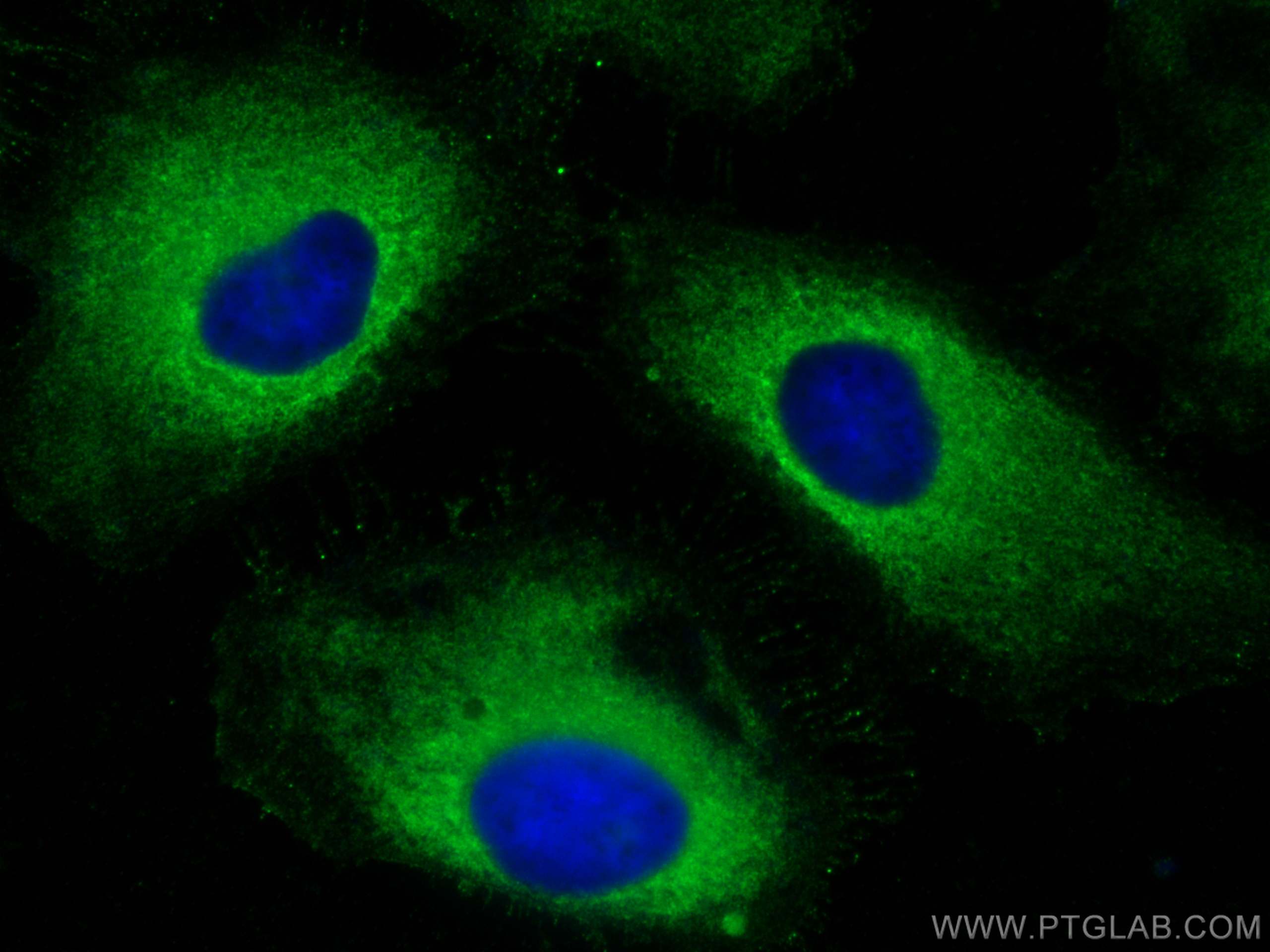 Immunofluorescence (IF) / fluorescent staining of HeLa cells using FARSA Polyclonal antibody (18121-1-AP)