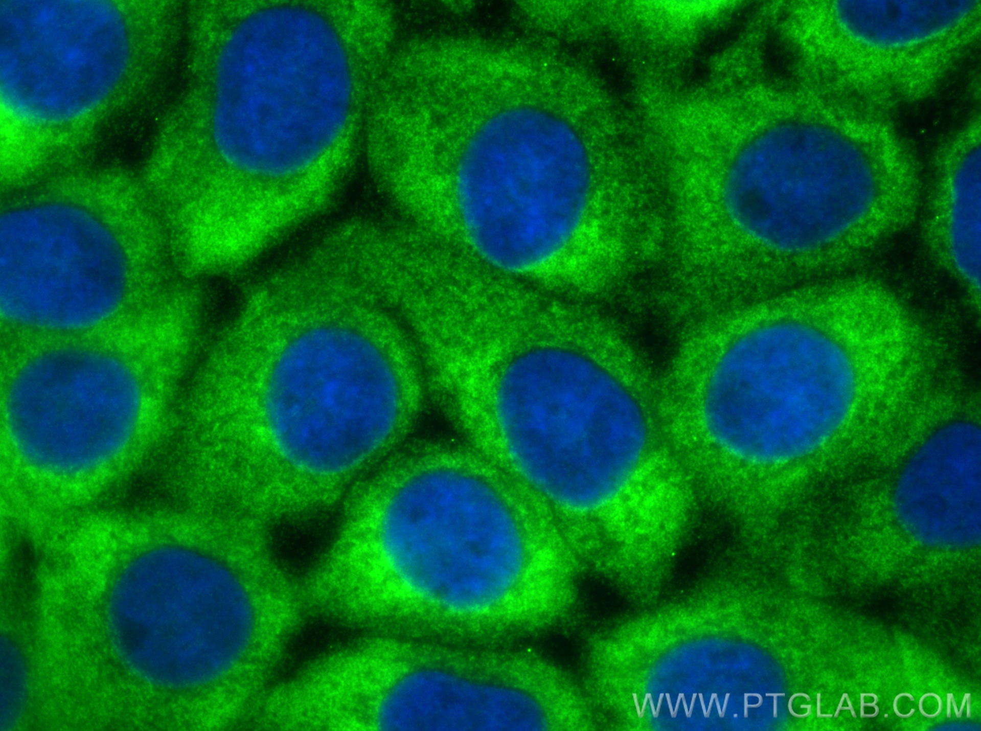 Immunofluorescence (IF) / fluorescent staining of A431 cells using FARSA Polyclonal antibody (18121-1-AP)