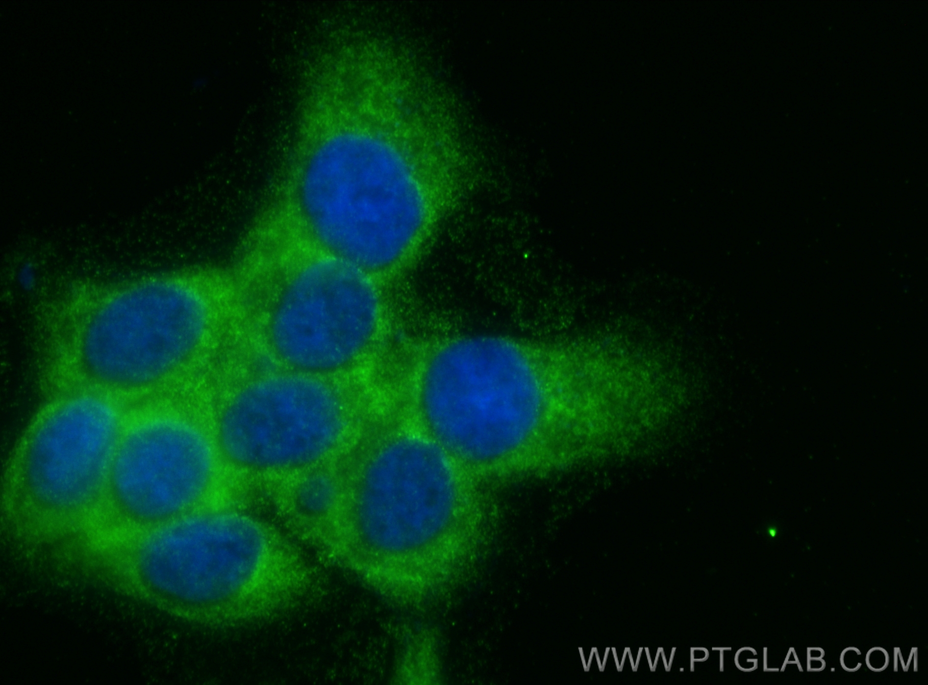 Immunofluorescence (IF) / fluorescent staining of A431 cells using FARSA Monoclonal antibody (67945-1-Ig)