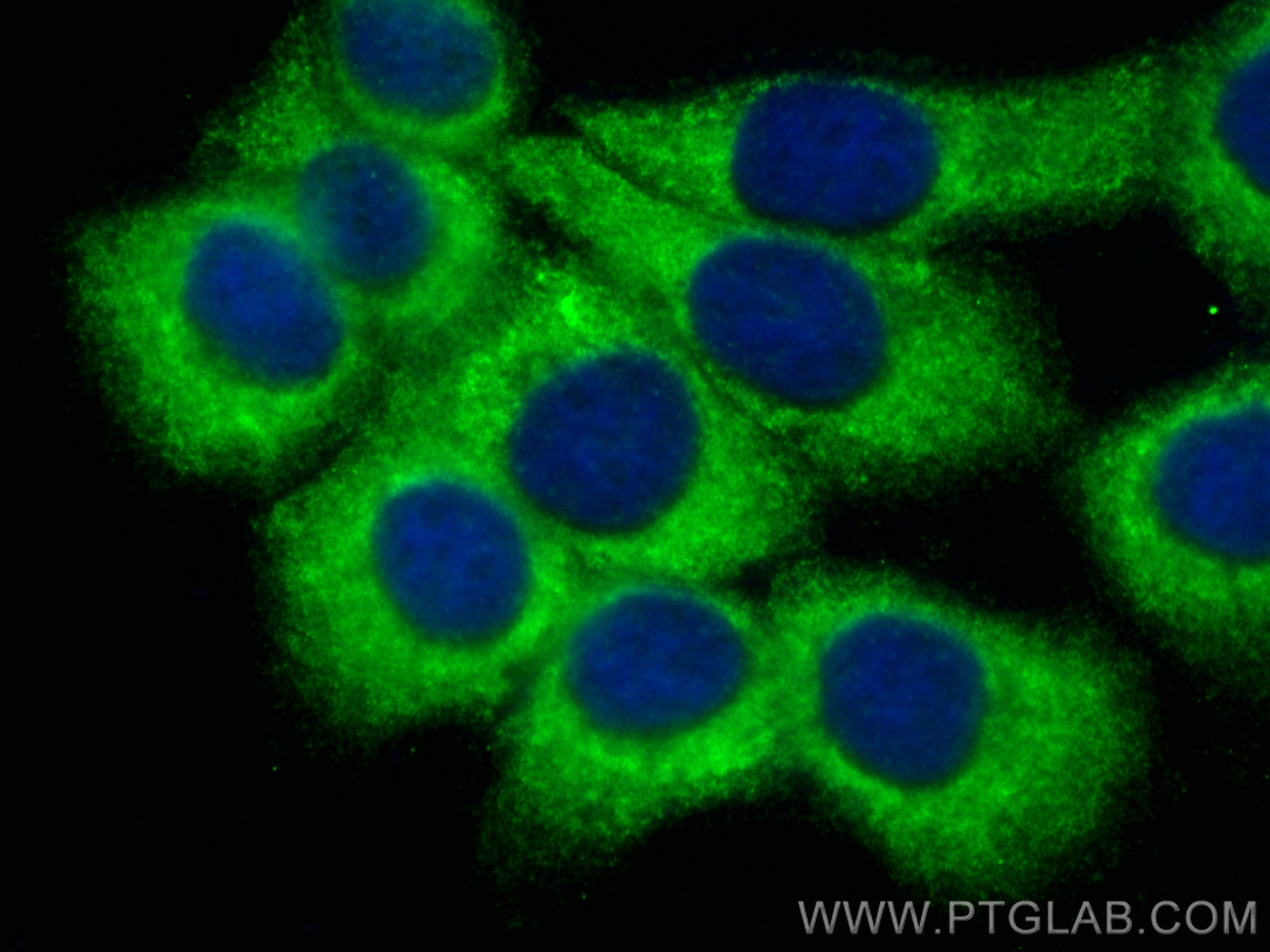 Immunofluorescence (IF) / fluorescent staining of A431 cells using CoraLite® Plus 488-conjugated FARSA Monoclonal ant (CL488-67945)