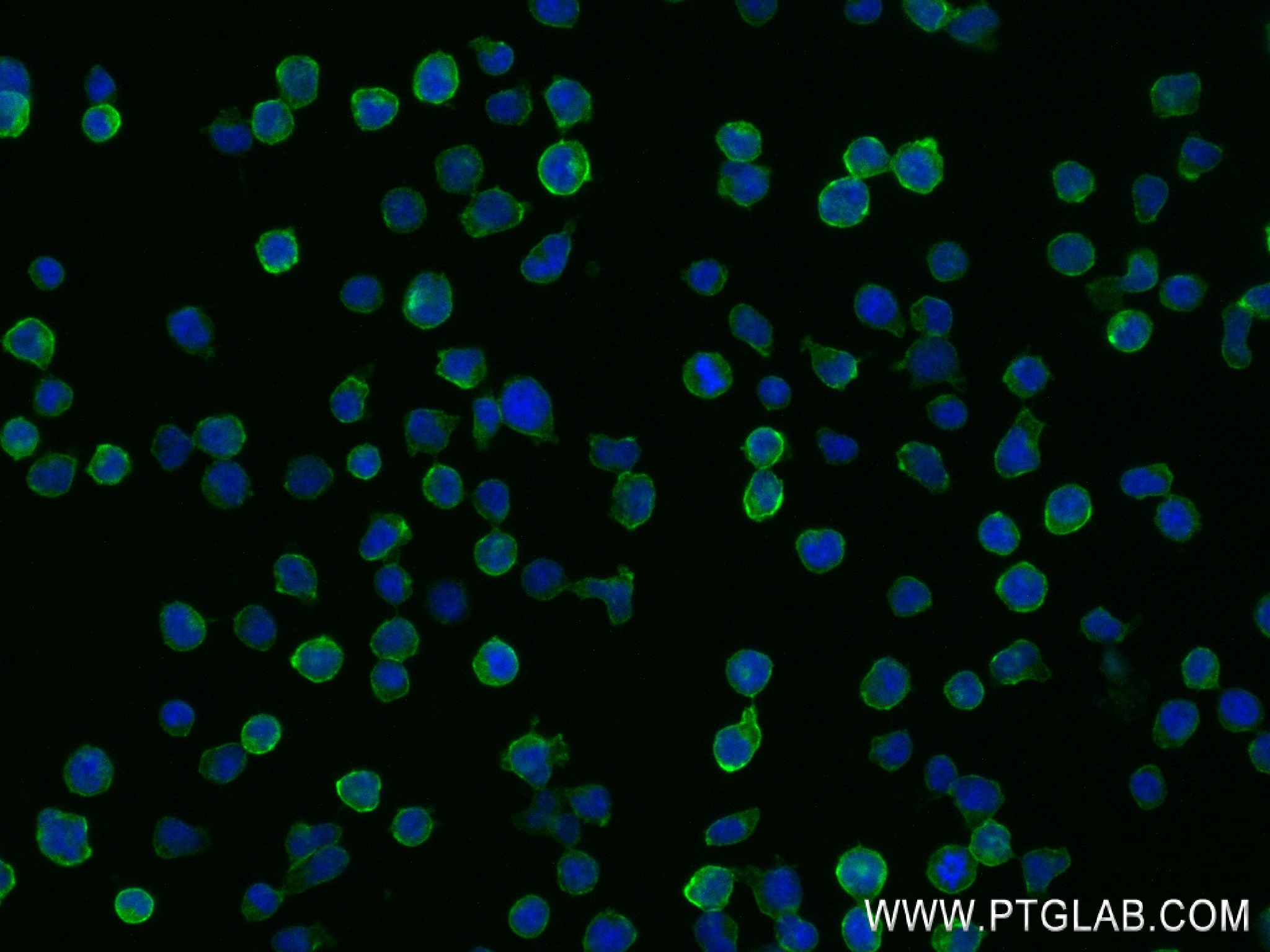 Immunofluorescence (IF) / fluorescent staining of Jurkat cells using FAS/CD95 Recombinant antibody (83400-5-RR)