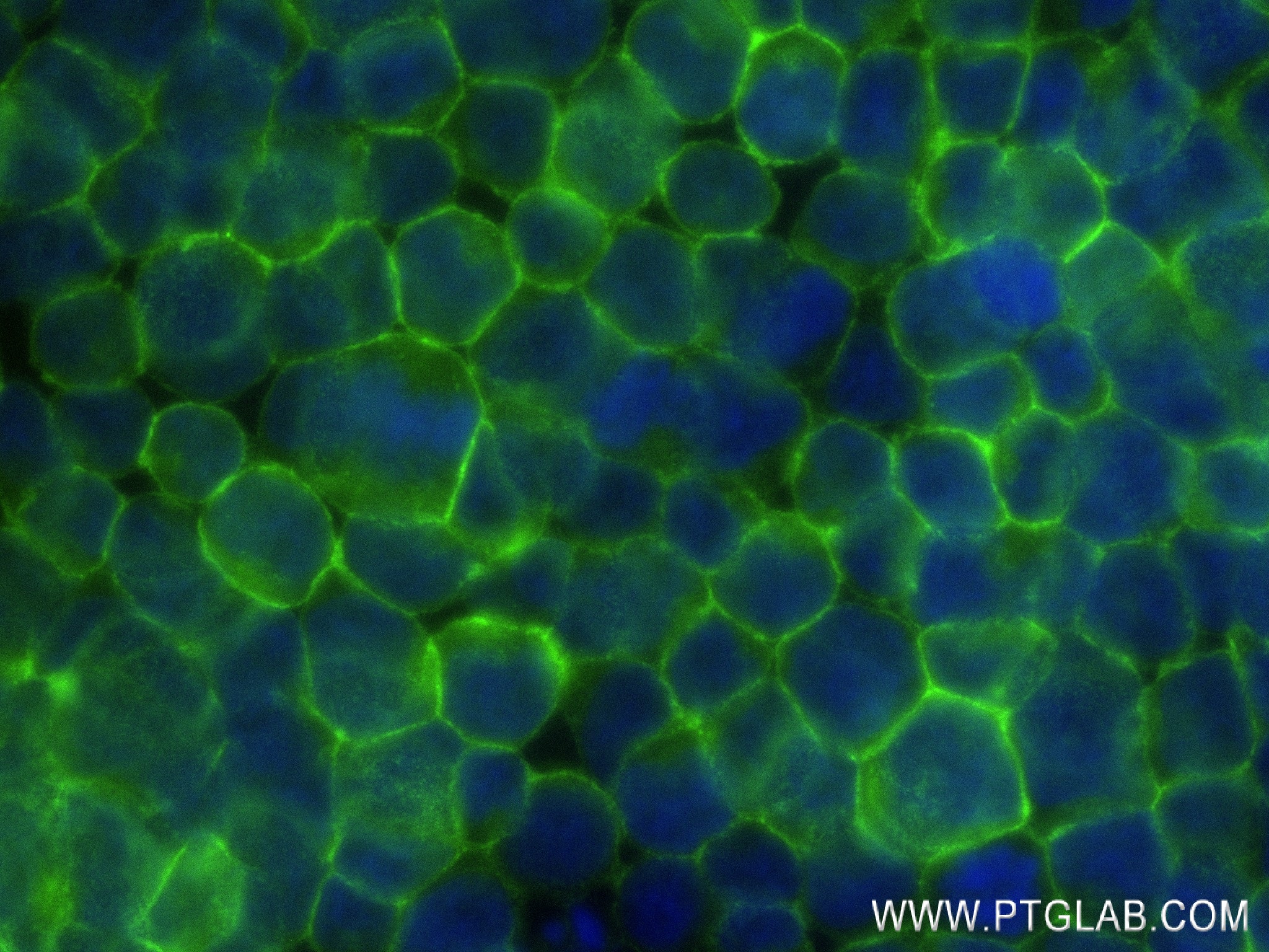 Immunofluorescence (IF) / fluorescent staining of Jurkat cells using FAS/CD95 Recombinant antibody (83400-5-RR)