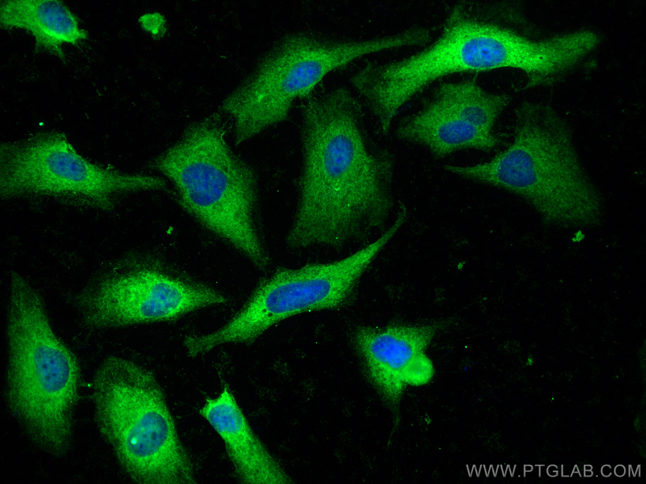 Immunofluorescence (IF) / fluorescent staining of HeLa cells using FASN Polyclonal antibody (10624-2-AP)