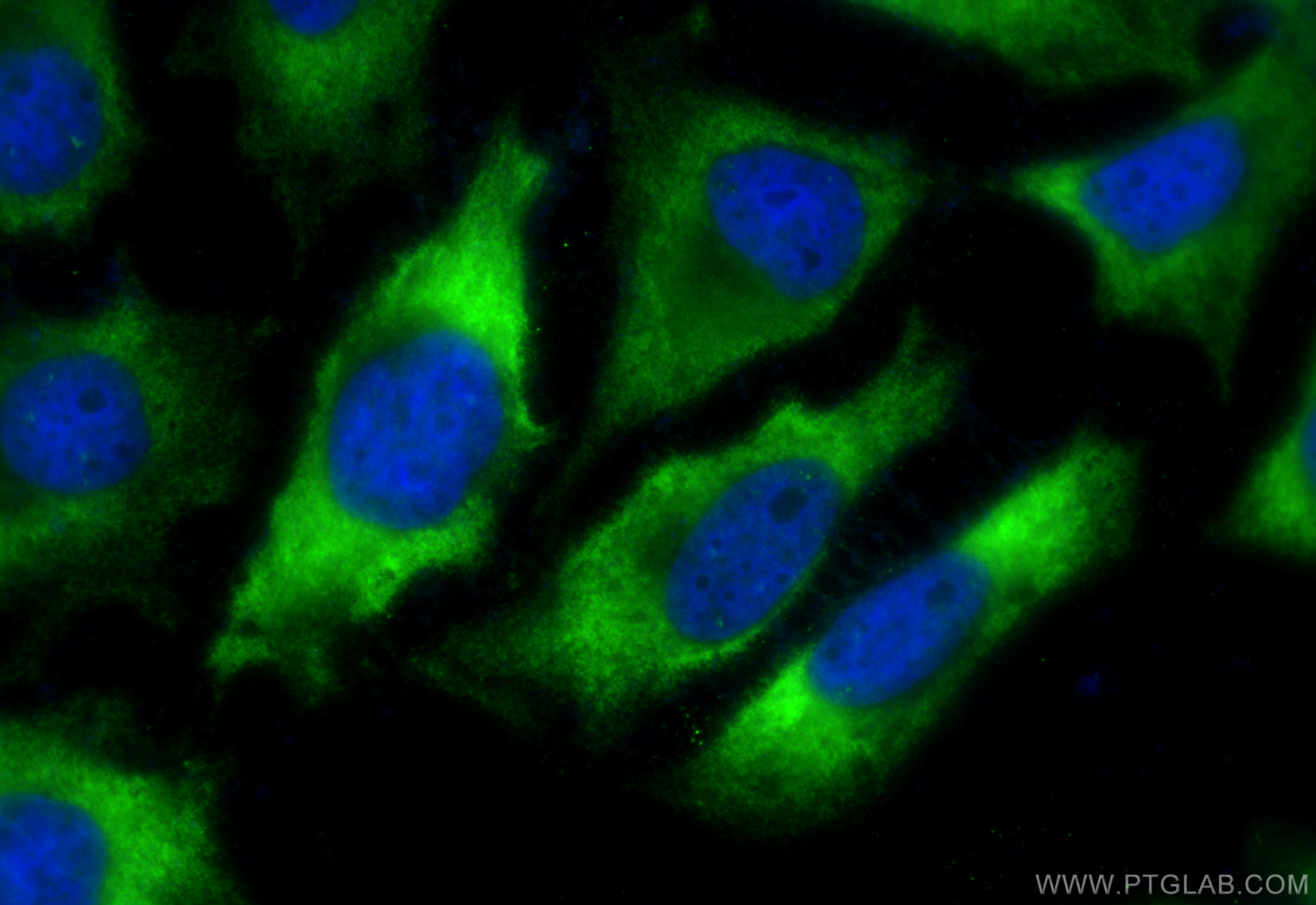 Immunofluorescence (IF) / fluorescent staining of HeLa cells using CoraLite® Plus 488-conjugated FASN Recombinant ant (CL488-81079)