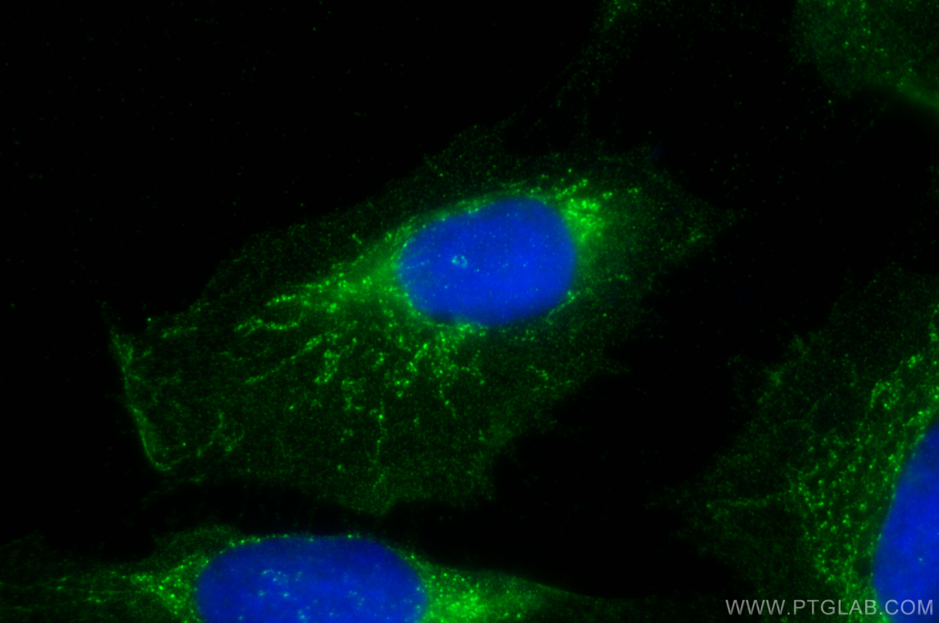 Immunofluorescence (IF) / fluorescent staining of U2OS cells using FASTKD2 Polyclonal antibody (17464-1-AP)