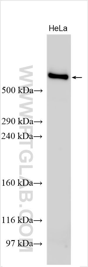 Western Blot (WB) analysis of various lysates using FAT1 Polyclonal antibody (30733-1-AP)