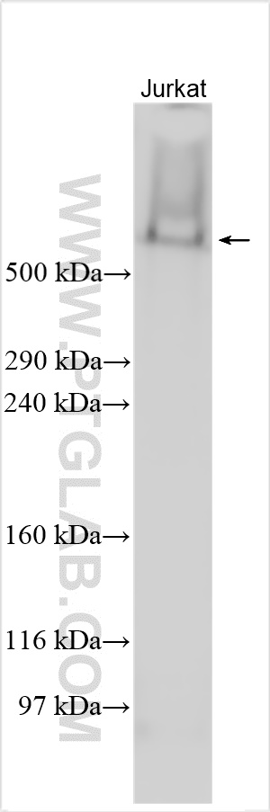 Western Blot (WB) analysis of various lysates using FAT1 Polyclonal antibody (30733-1-AP)