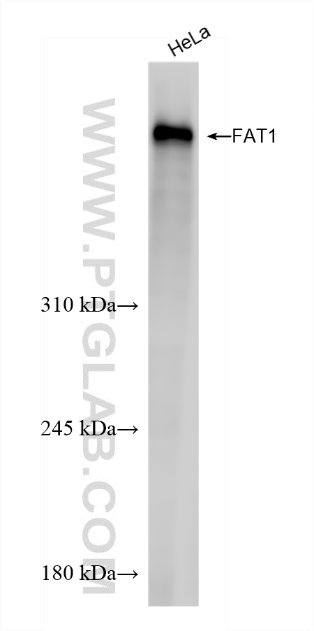 Western Blot (WB) analysis of HeLa cells using FAT1 Recombinant antibody (84279-3-RR)