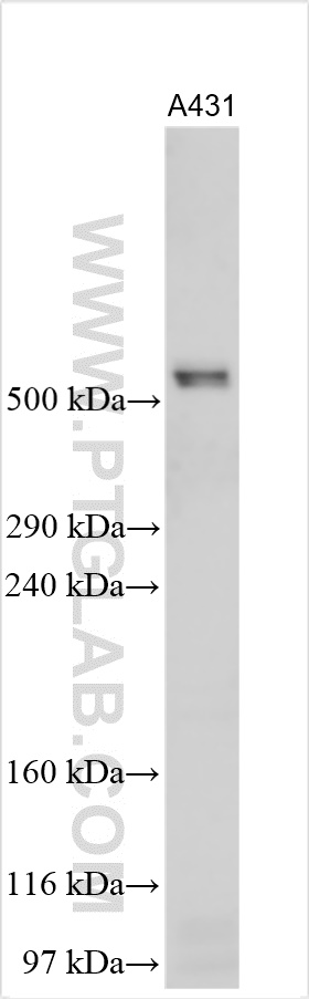 Western Blot (WB) analysis of various lysates using FAT2 Polyclonal antibody (31490-1-AP)