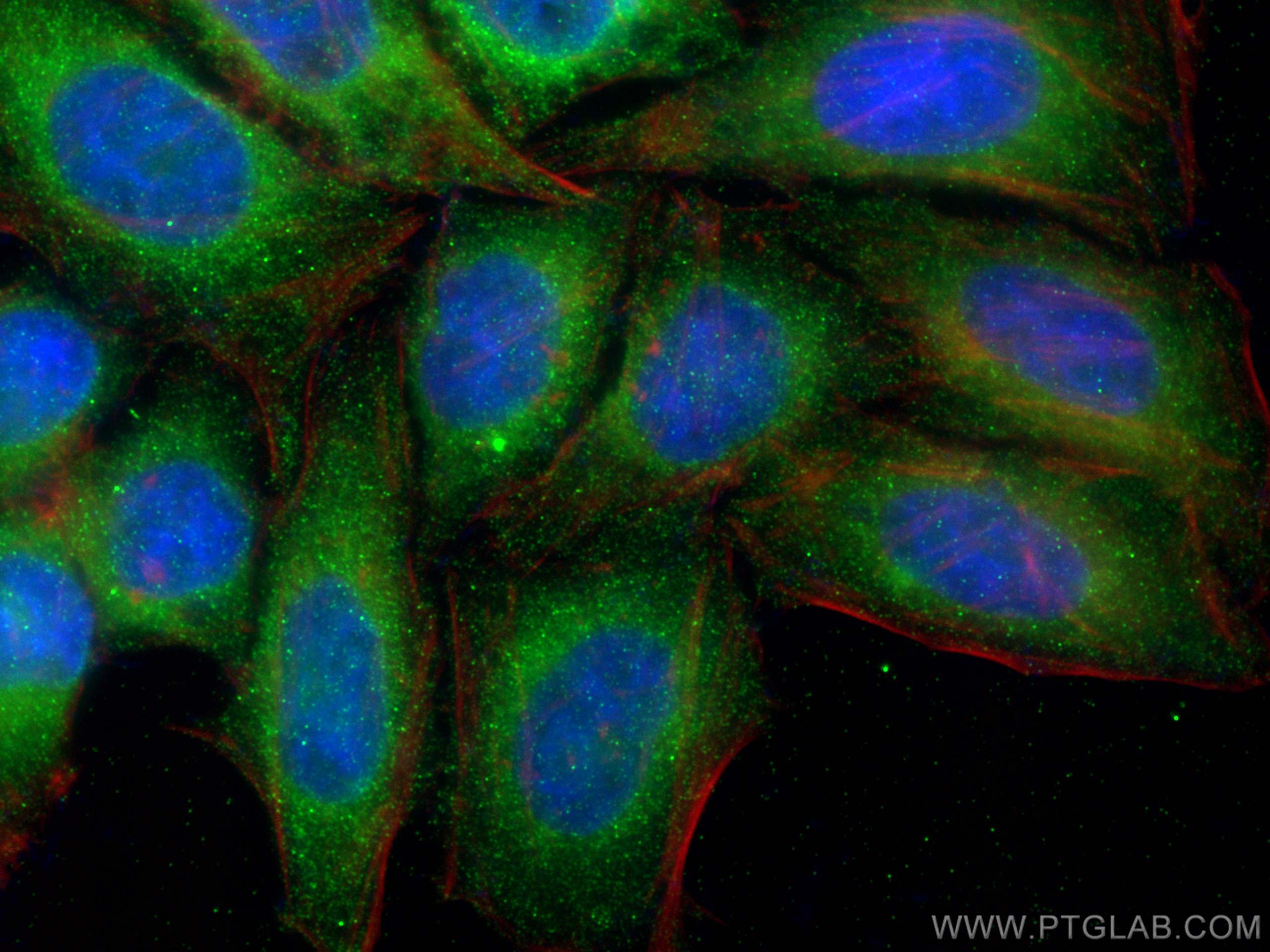 Immunofluorescence (IF) / fluorescent staining of HepG2 cells using FATP2 Monoclonal antibody (68074-1-Ig)