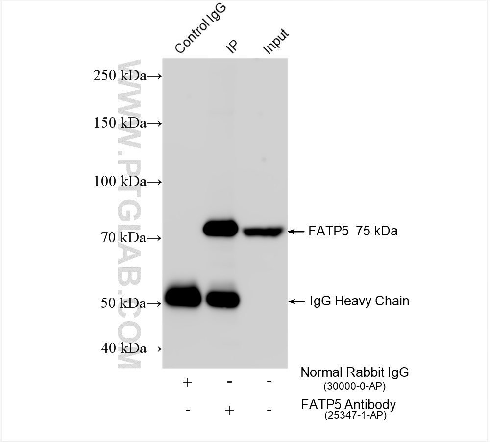 Immunoprecipitation (IP) experiment of rat liver tissue using FATP5 Polyclonal antibody (25347-1-AP)