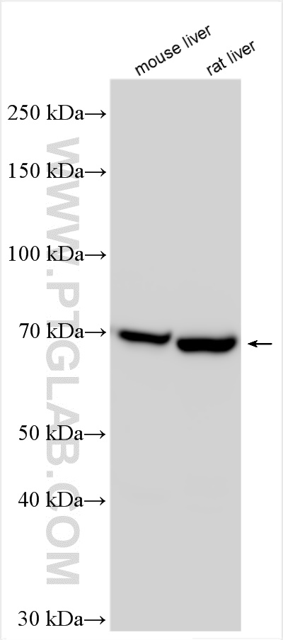 Western Blot (WB) analysis of various lysates using FATP5 Polyclonal antibody (25347-1-AP)