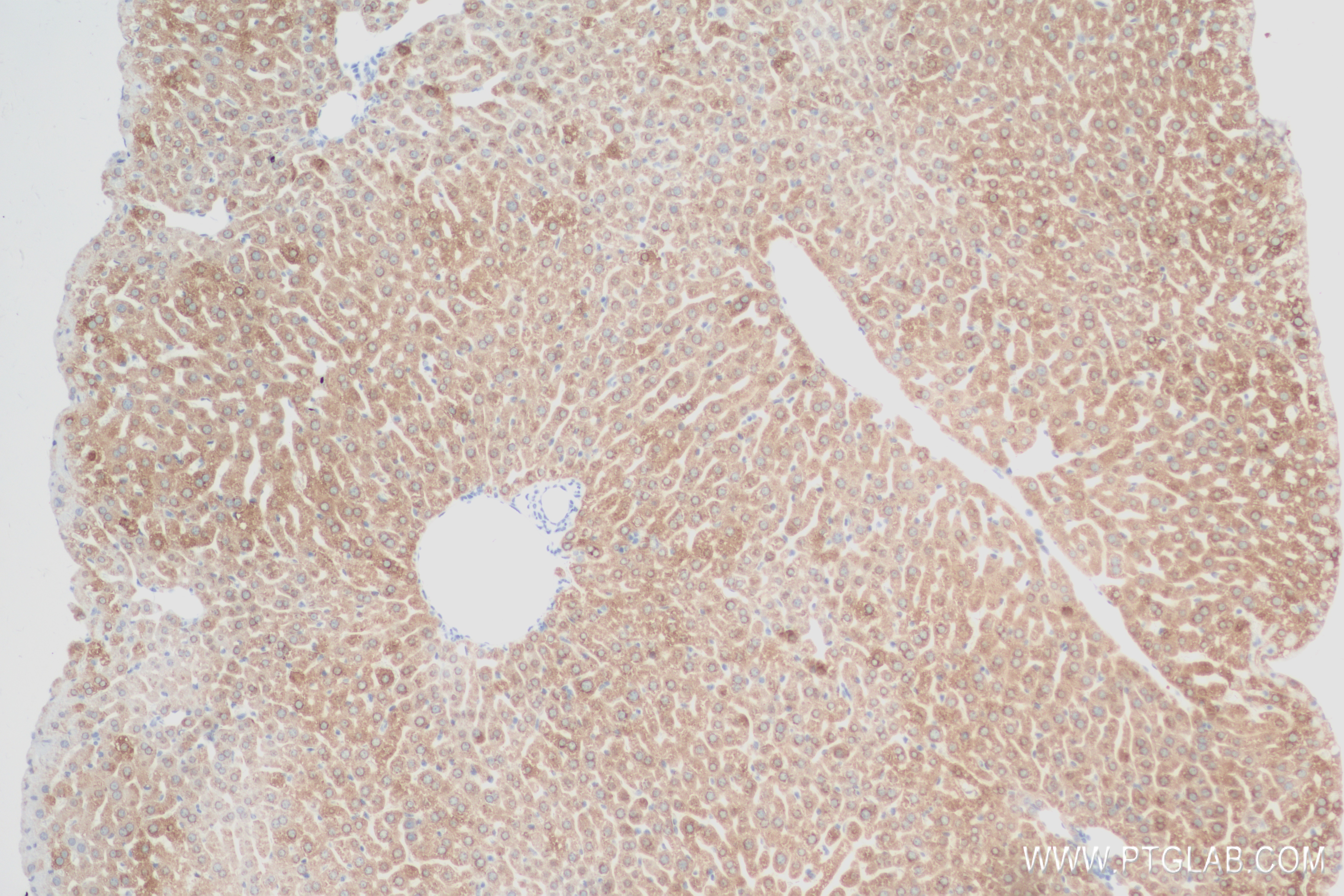 Immunohistochemistry (IHC) staining of mouse liver tissue using FATP5/SLC27A5 Recombinant antibody (84557-1-RR)