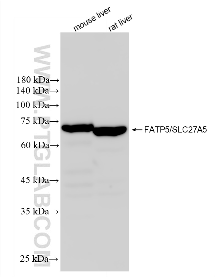 Western Blot (WB) analysis of various lysates using FATP5/SLC27A5 Recombinant antibody (84557-1-RR)