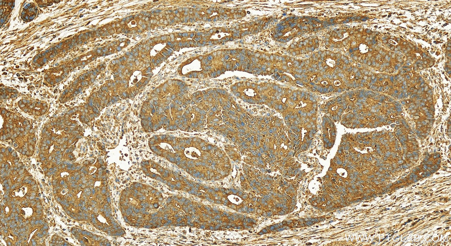 Immunohistochemistry (IHC) staining of human stomach tissue using FAU Polyclonal antibody (13581-1-AP)