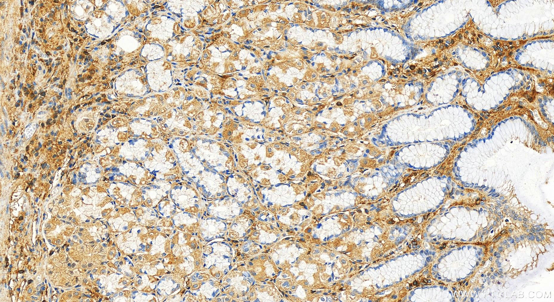 Immunohistochemistry (IHC) staining of human stomach tissue using Fibulin-1 Polyclonal antibody (20425-1-AP)