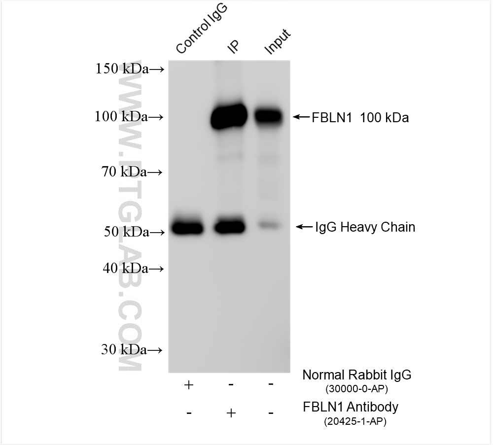 Immunoprecipitation (IP) experiment of human placenta tissue using Fibulin-1 Polyclonal antibody (20425-1-AP)