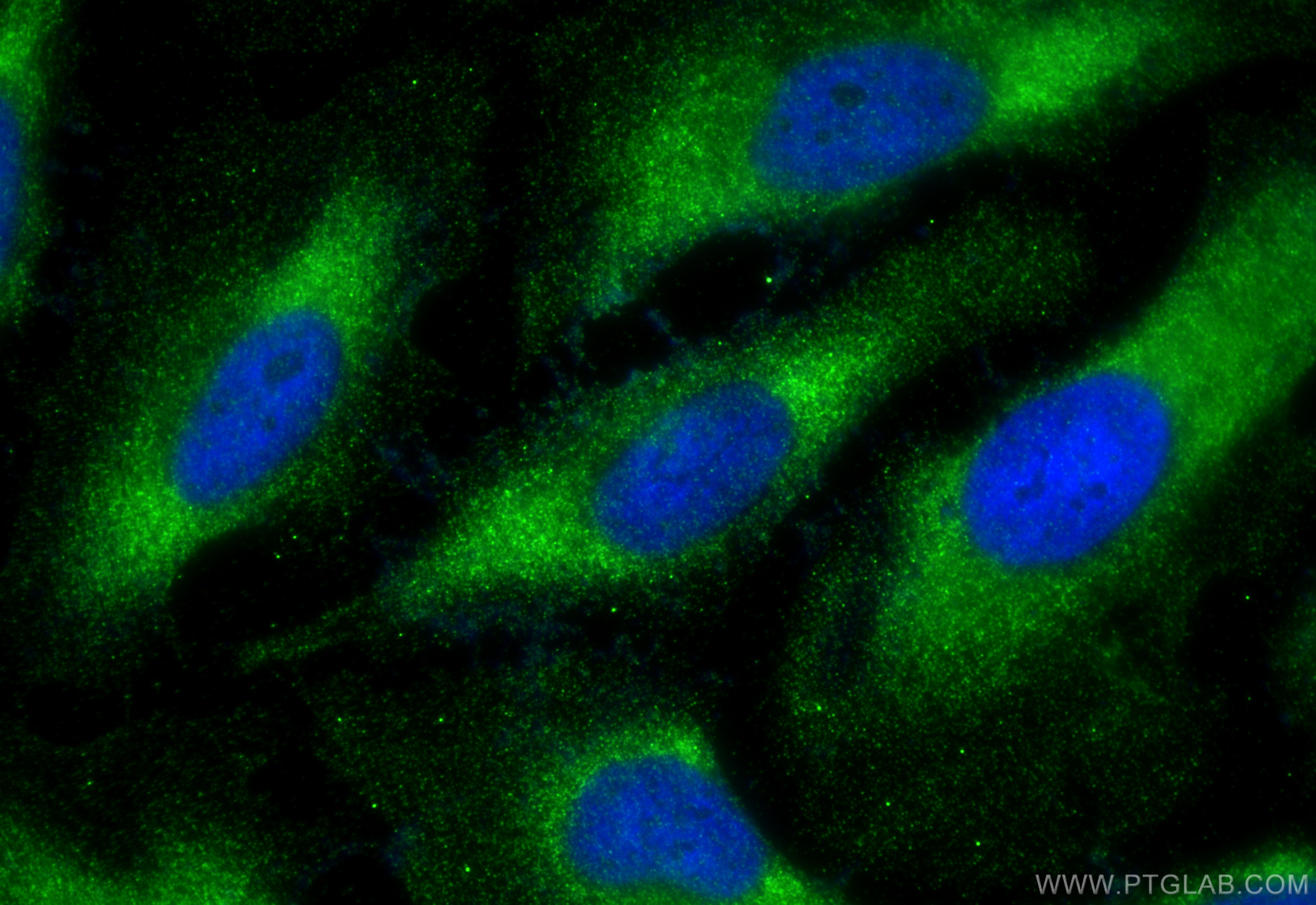 Immunofluorescence (IF) / fluorescent staining of HeLa cells using FBP1 Polyclonal antibody (12842-1-AP)